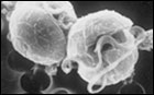Pfisteria micrograph by Joann Burkholder