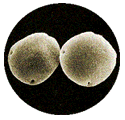 hickory pollen showing smooth exterior
