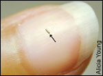 hair thin microwire on a thumbnail by Alicia Young